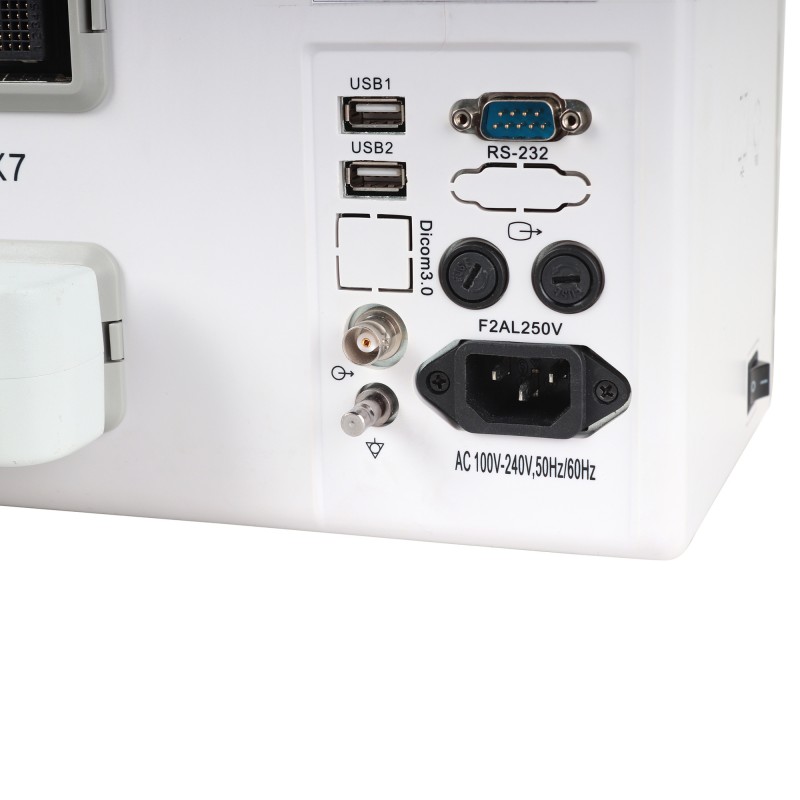 УЗИ сканер Med-Mos CMS600B3 УЗИ сканер Med-Mos CMS600B3