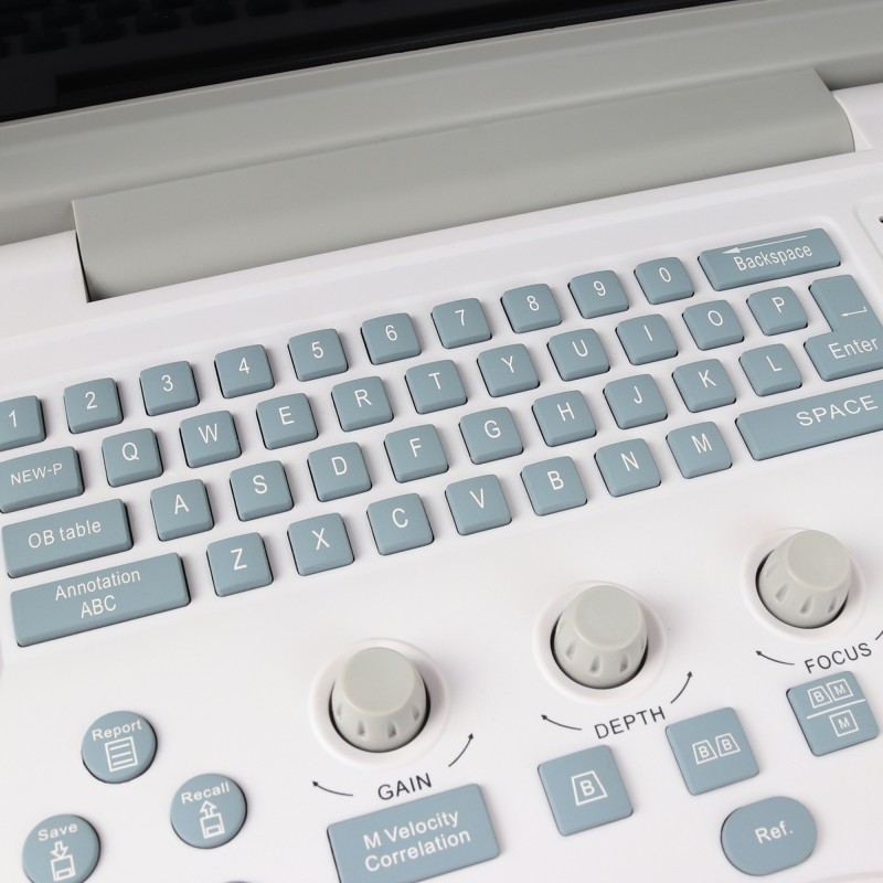 УЗИ сканер Med-Mos CMS600B3 УЗИ сканер Med-Mos CMS600B3