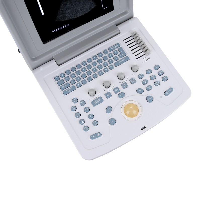 УЗИ сканер Med-Mos CMS600B3 УЗИ сканер Med-Mos CMS600B3