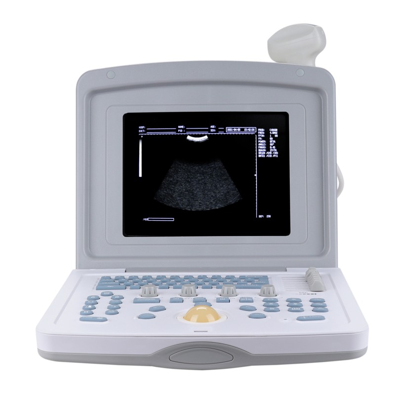 УЗИ сканер Med-Mos CMS600B3 УЗИ сканер Med-Mos CMS600B3