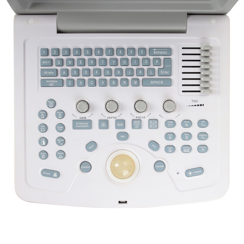 УЗИ сканер Med-Mos CMS600B3 УЗИ сканер Med-Mos CMS600B3