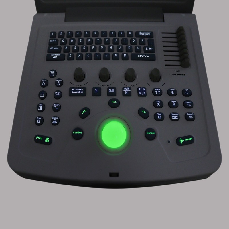 УЗИ сканер Med-Mos CMS600B3 УЗИ сканер Med-Mos CMS600B3