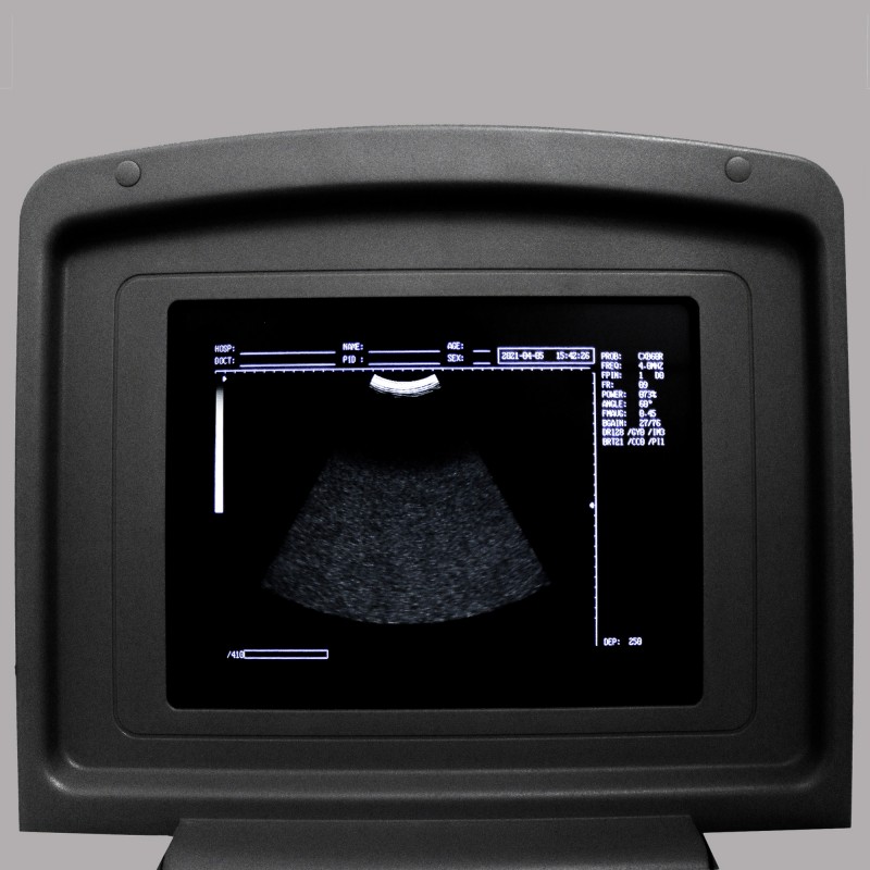 УЗИ сканер Med-Mos CMS600B3 УЗИ сканер Med-Mos CMS600B3