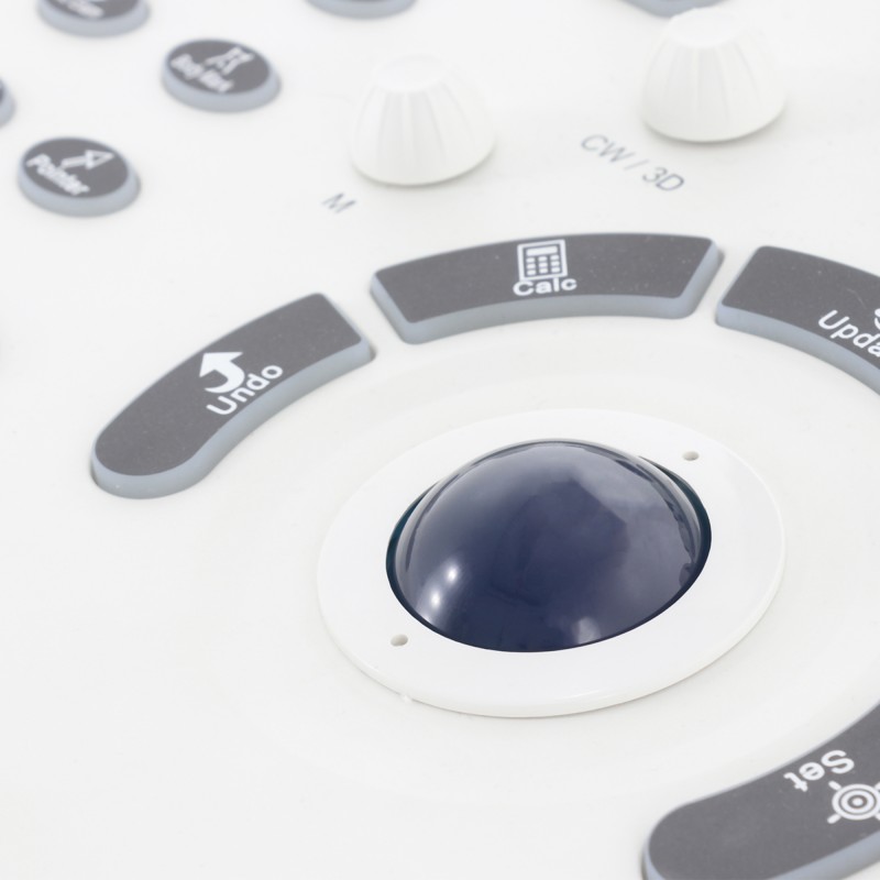 Аппарат ультразвуковой диагностики Med-Mos ЕМР3000 пять датчиков (Линейный, Конвексный, Секторный, Внутриполостной, Микроконвексный)